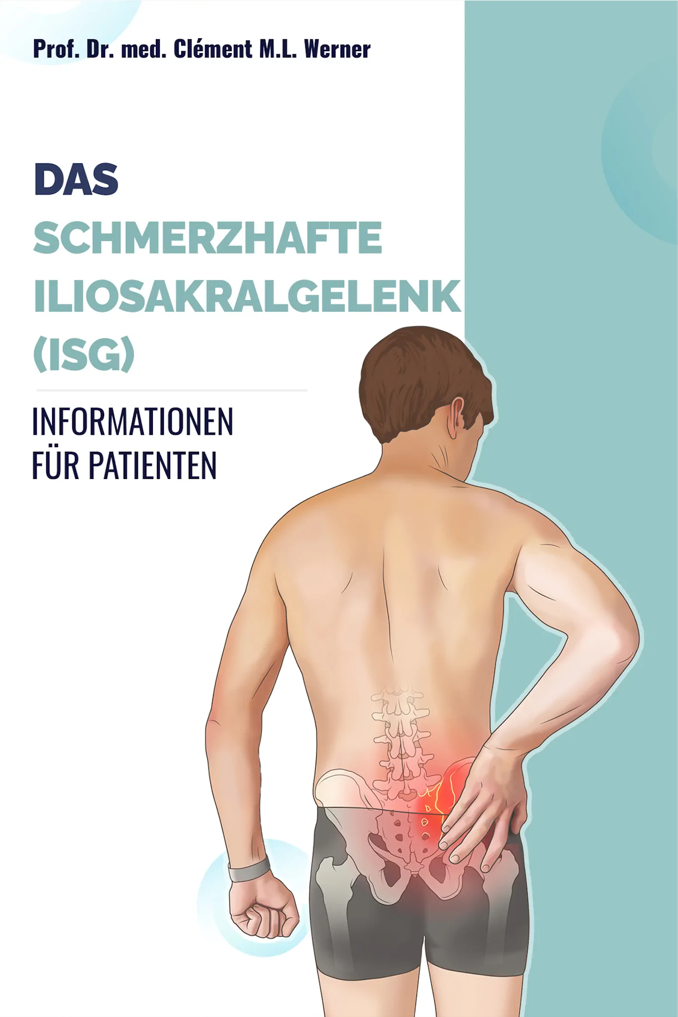 Das Schmerzhafte Iliosakralgelenk (ISG): Informationen für Patienten